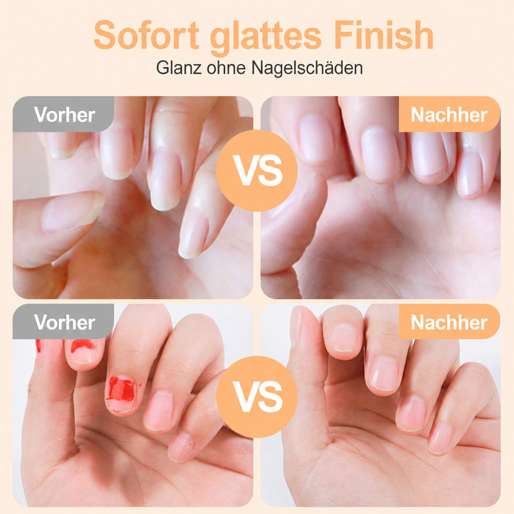 upsell 🌟 2-in-1-Smart-Elektronagelschere & -Polierer ✂️💅